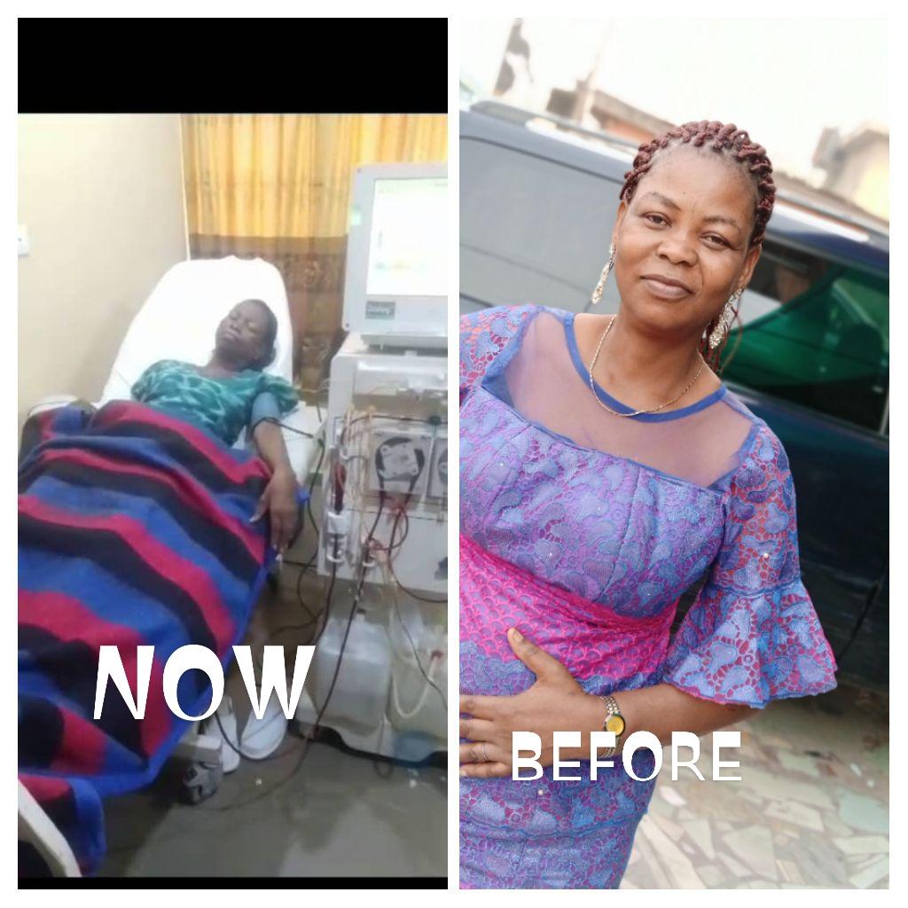 Retired NAN staff appeals for N40m for wife’s kidney transplant
